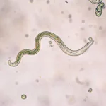 نماتد چیست؟ حقیقت‌های شگفت‌انگیز درباره این آفت مخفی که گیاهان شما را تهدید می‌کند